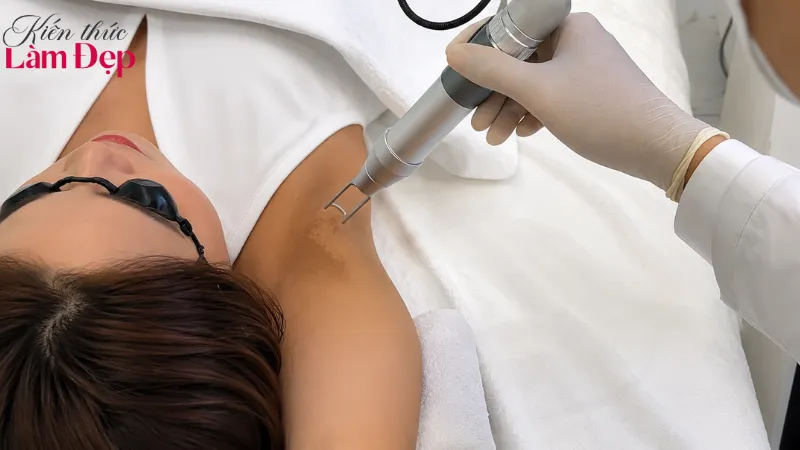Deep L-Picosure giúp trị thâm chính xác, an toàn, cá nhân hóa