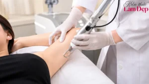 Có Nên Trị Thâm Body Bằng Deep L-Picosure Không?
