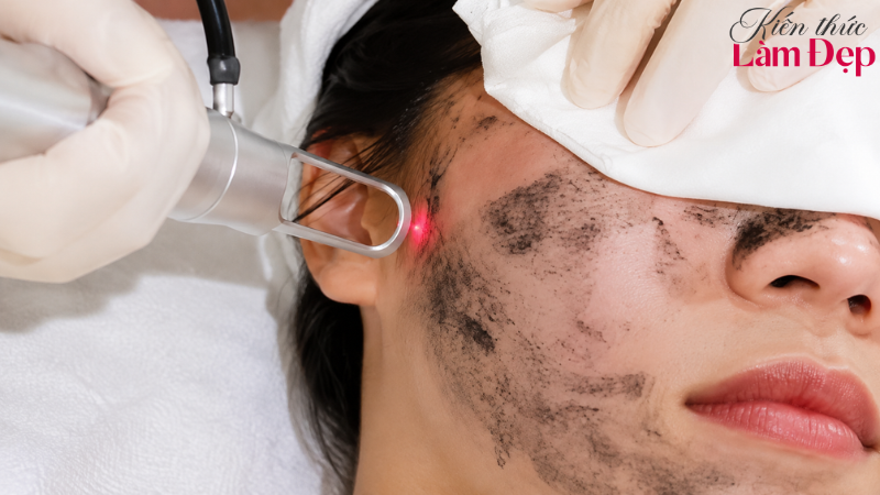 Dr.Laser Bio YL trẻ hóa da, cảm giác châm chích nhẹ