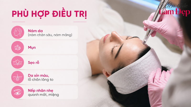 Dermaperfecta hỗ trợ cải thiện nám, mụn, sẹo rỗ, nếp nhăn