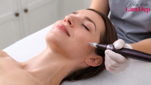 Công Nghệ Dermaperfecta Là Gì? Giải Pháp Trị Sẹo Rỗ, Tái Tạo Da Mịn Màng