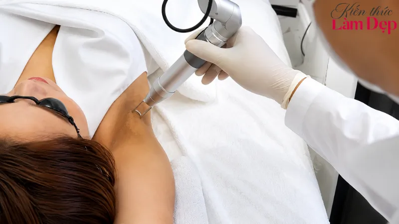 Trị thâm Deep L-Picosure ít đau khi điều trị