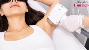 Công Nghệ Triệt Lông Nano Laser Có Tốt Không? Hiệu Quả Thế Nào?