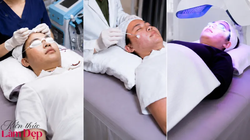 Doctor 4 Treatment là phác đồ trị mụn cá nhân hóa gồm 4 giai đoạn