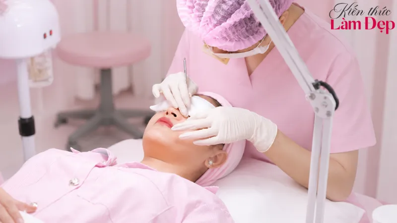Kỹ thuật lấy nhân mụn chuẩn y khoa giúp làm sạch bít tắc