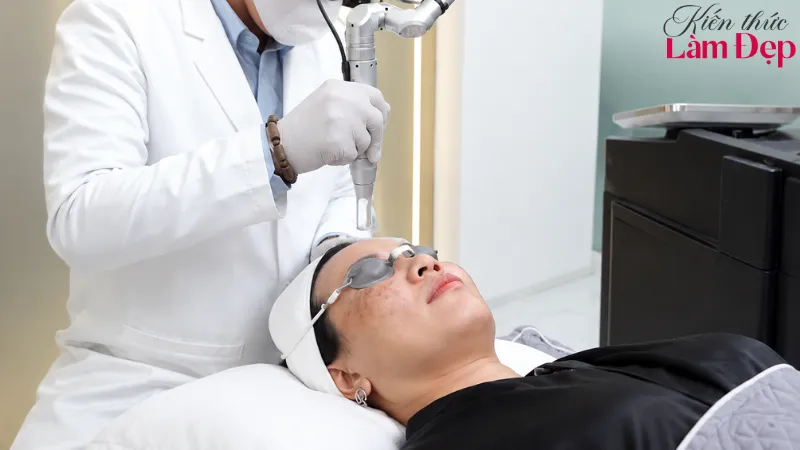 Pico Melasma là công nghệ trị nám sử dụng laser pico tiên tiến