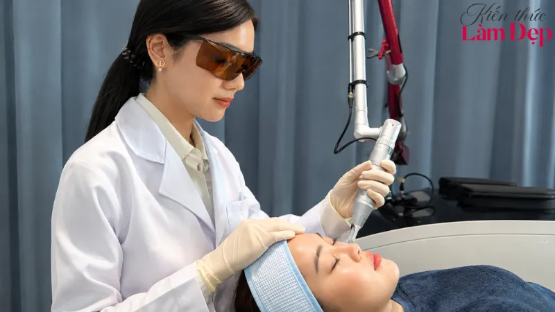 Pico Melasma sử dụng Laser Pico phát ra các chùm tia xung cực ngắn