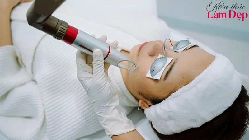 Liệu trình Pico Melasma cần bao nhiêu buổi mới thấy rõ kết quả?