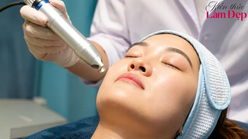 Tất Tần Tật Về Pico Melasma - Công Nghệ Trị Nám Đang Được Quan Tâm Hiện Nay
