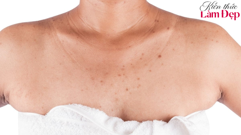 Premium Whitening phù hợp với làn da xỉn màu