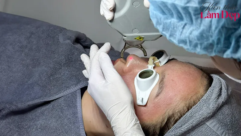Shynh Perfect Treatment kết hợp công nghệ laser và phương pháp tái tạo da