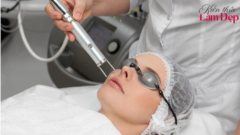 Chi phí Laser Q-Switched thường thấp hơn Deep L-Picosure
