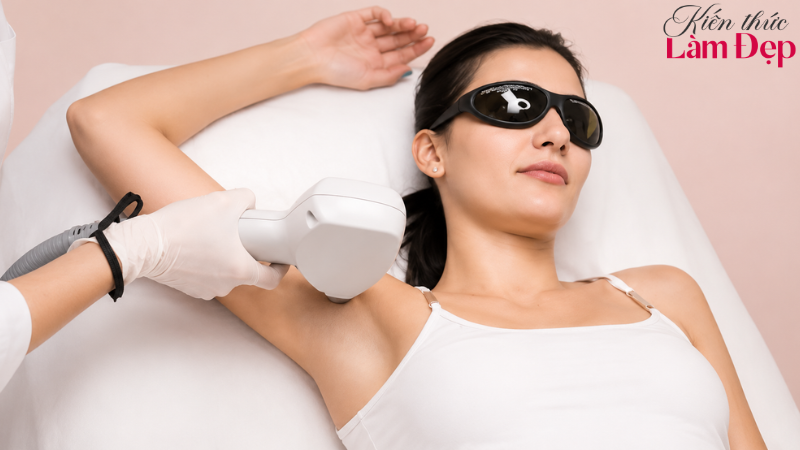 So Sánh Công Nghệ Triệt Lông Shr Ice2 Với Diode Laser