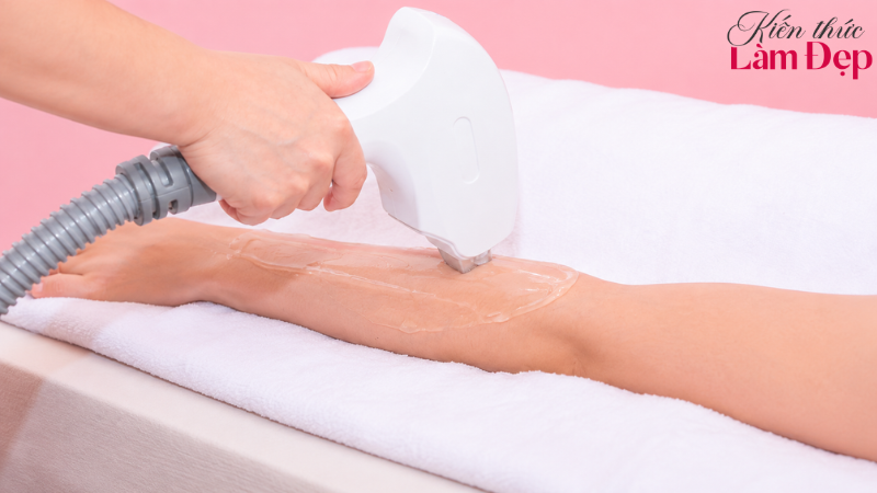 Hai công nghệ tác động đến nang lông theo cách khác nhau