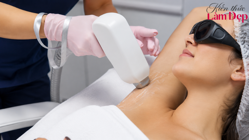 Nên tham khảo ý kiến chuyên môn trước khi chọn công nghệ triệt lông
