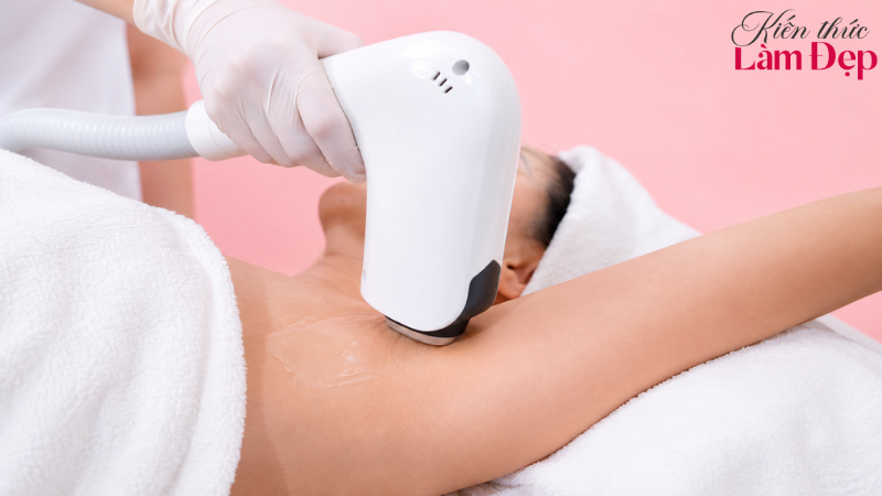 Công Nghệ Triệt Lông Nano Laser Và Diode Laser Khác Nhau Như Thế Nào?