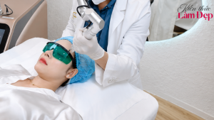 Trị Thâm Bằng Công Nghệ Deep L-Picosure Có Tốt Không?