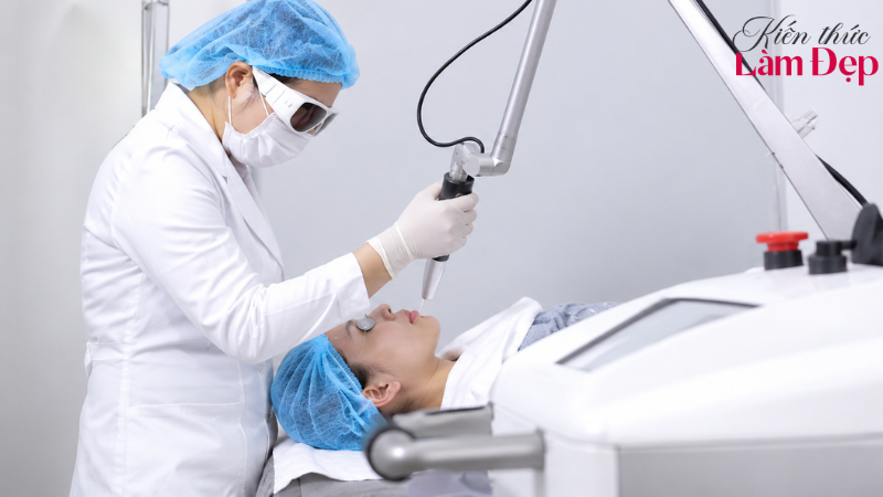 Giá liệu trình trị thâm Deep L-Picosure dao động tùy theo từng vùng da thực hiện