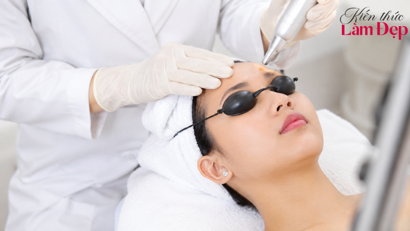 Công nghệ Deep L-Picosure quyết định hiệu quả và chi phí