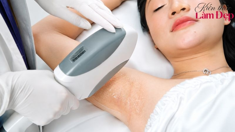 Hai phương pháp kiểm soát nhiệt tại nang lông theo cách khác nhau