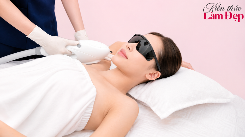 Nên tham khảo ý kiến chuyên môn trước khi chọn phương pháp triệt lông