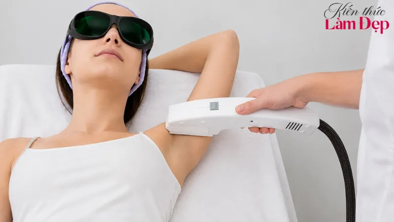 Chuẩn bị và chăm sóc đúng giúp triệt lông an toàn hơn